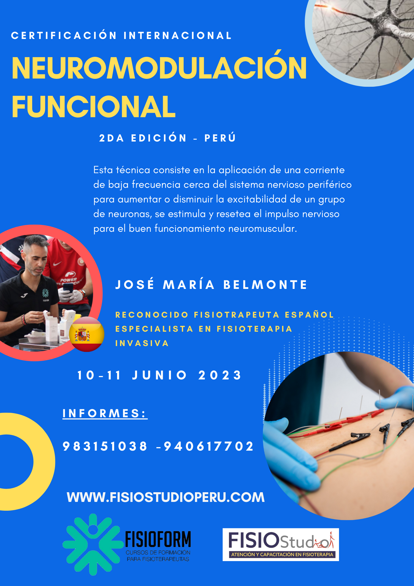 NEUROMODULACIÓN